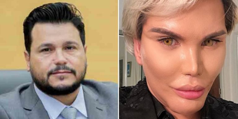 Presidente da Assembleia Legislativa de Rondônia passa por nova cirurgia plástica com sucesso