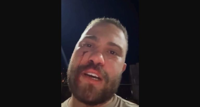 Diego Pupe,  ex-caso de Jair Renan Bolsonaro, é agredido em Brasília
